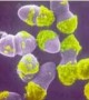 Anti-biofilm molecule may help fight superbugs