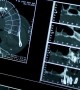 Making clear progress – Latest innovations in dental imaging and viewing