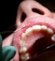 Only 1 Percent of Canadian Children See A Dentist within Their First Year of Life